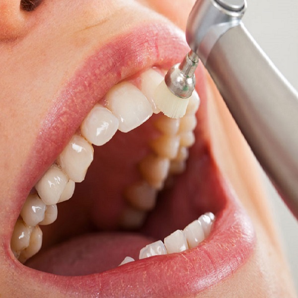 https://neptunedentist.com/assets/img/dental-cleaning_3.jpg