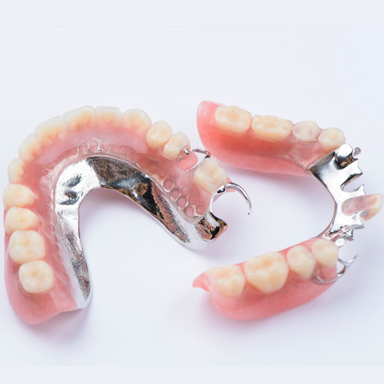 partial denture with metal base